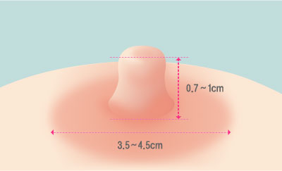 콘텐츠이미지